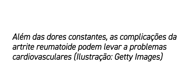 Al m das dores constantes, as complica es da artrite reumatoide podem levar a problemas cardiovasculares (Ilustra  o...