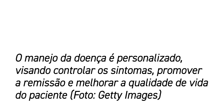 O manejo da doen a  personalizado, visando controlar os sintomas, promover a remiss o e melhorar a qualidade de vida...