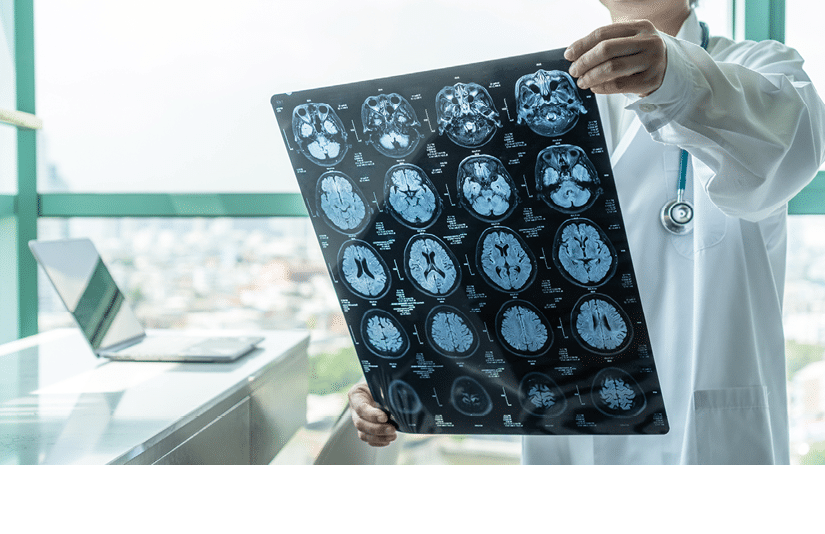 Brain disease diagnosis with medical doctor seeing Magnetic Resonance Imaging (MRI) film diagnosing elderly ageing patient neurodegenerative illness problem for neurological medical treatment